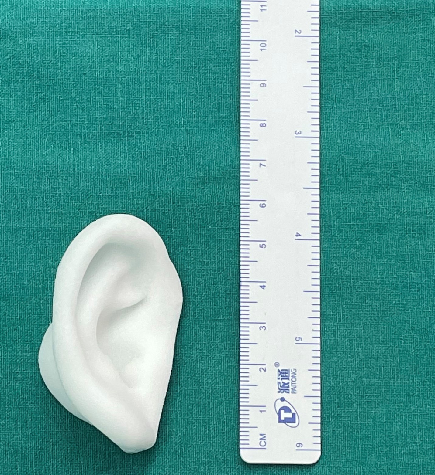 耳朵重建和听力重建康复一次完成,无需二次手术!