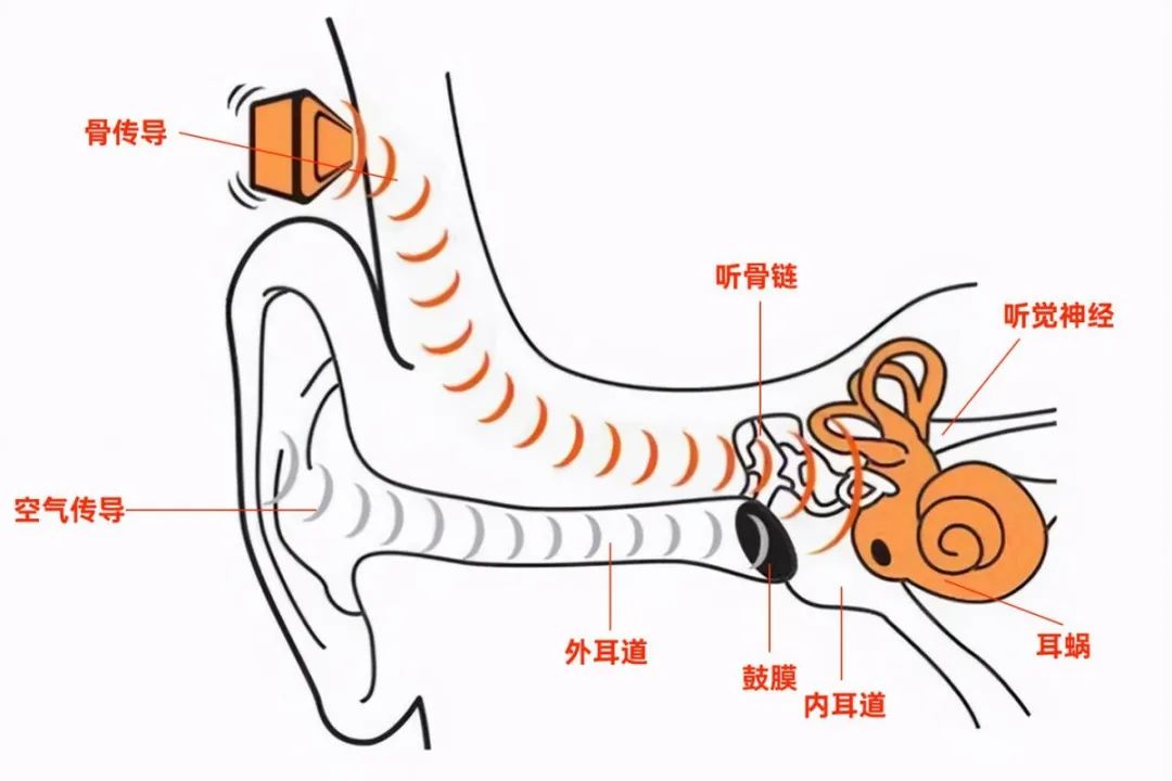 听觉中枢 位置图片