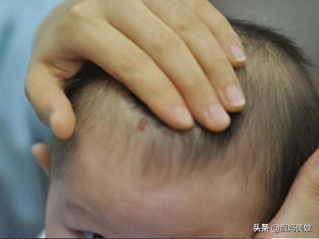 宝宝身上这4个地方长痣将来非富即贵,有一项的宝妈就偷着乐吧