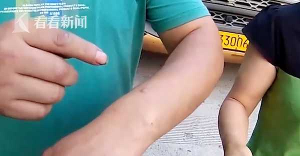 视频|开车犯困用烟头烫手?警察都心疼了