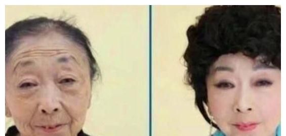 马玉琴与爱人结婚遭到双方家庭反对曾因自卑外貌做整形手术