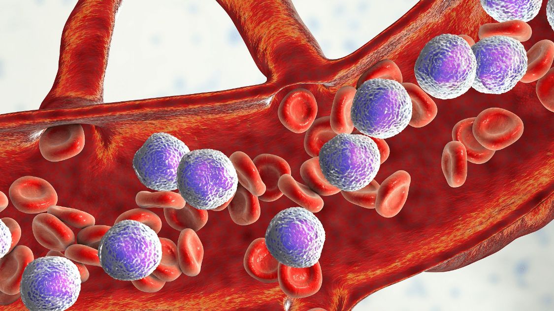 这3类食物或会增加患白血病的风险，为了健康，建议尽早远离休闲区蓝鸢梦想 - Www.slyday.coM