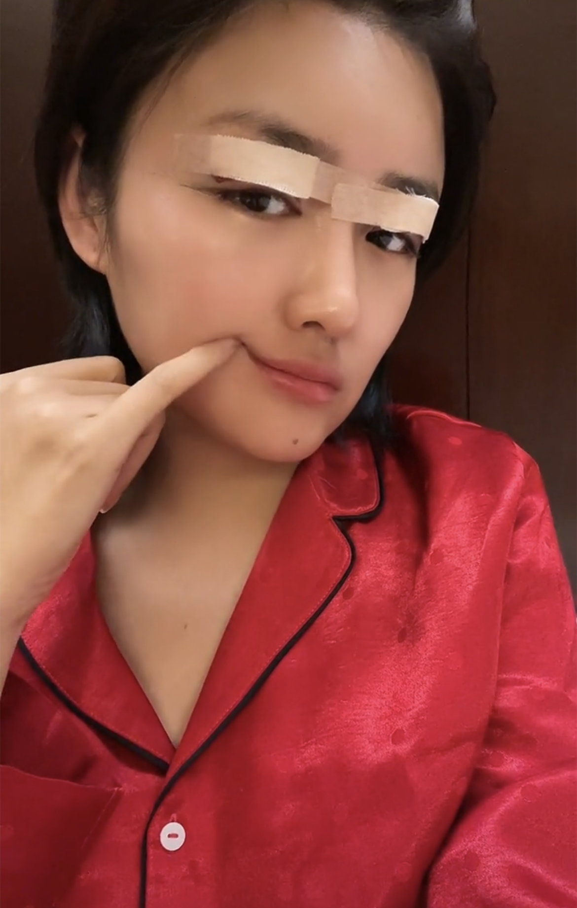 本山传媒艺人娇娇承认整容脸上裹满纱布曾因身家千万备受质疑