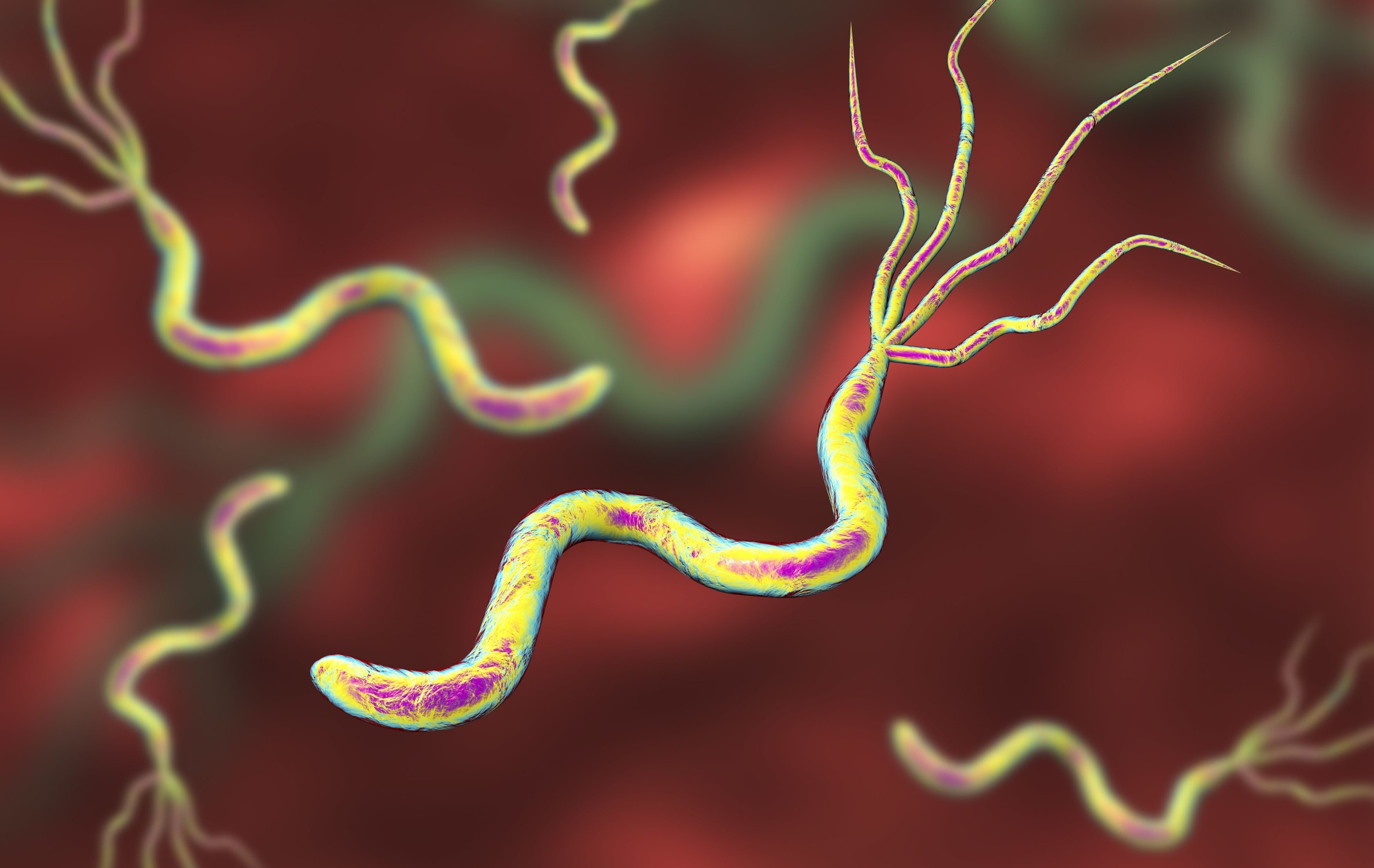 幽门螺杆菌被美国列为明确致癌物专家详解防与治
