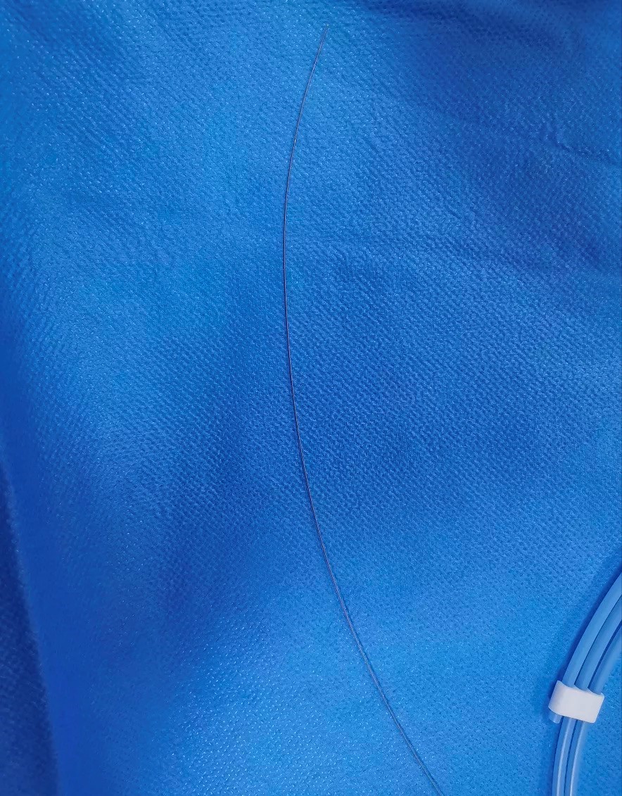 这家县医院里的"金属导丝",一年间救了上百人|心梗_新浪新闻