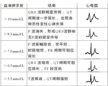 高鉀血癥時心電圖改變可表現為傳導異常和各種緩慢性或快速性心律失常