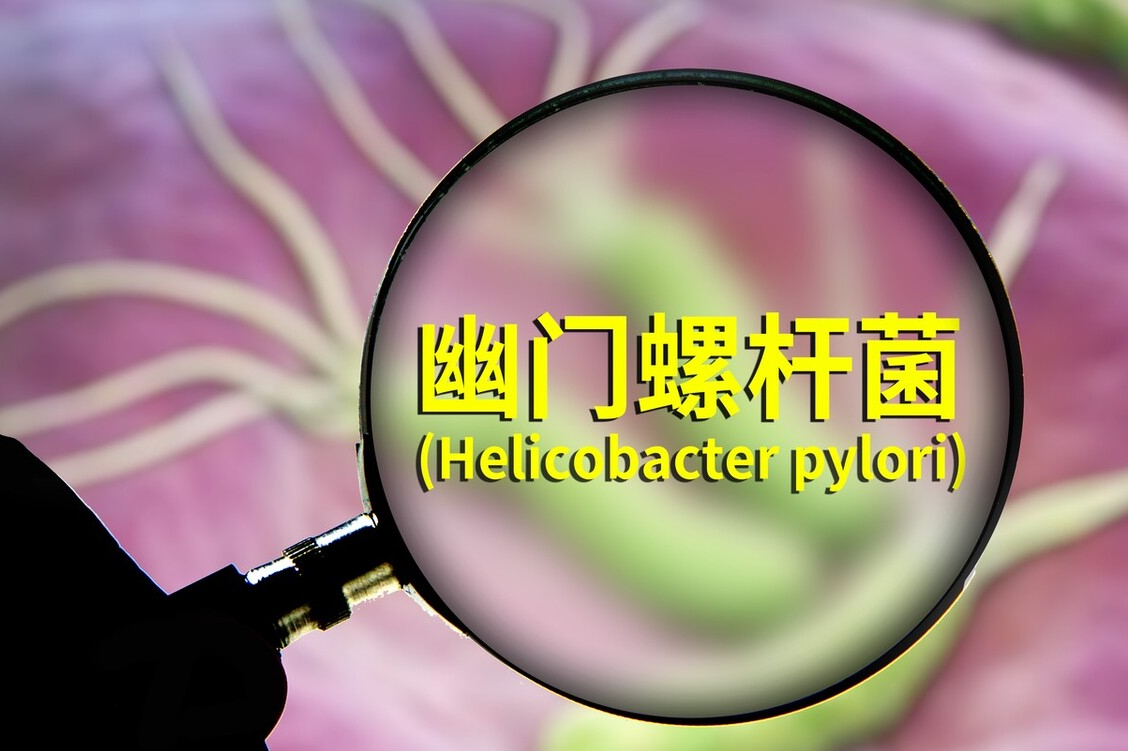 幽门螺杆菌检查值2000,就离胃癌不远了?辟谣为你讲出实情休闲区蓝鸢梦想 - Www.slyday.coM 幽门螺杆菌检查值2000,就离胃癌不远了?辟谣为你讲出实情休闲区蓝鸢梦想 - Www.slyday.coM