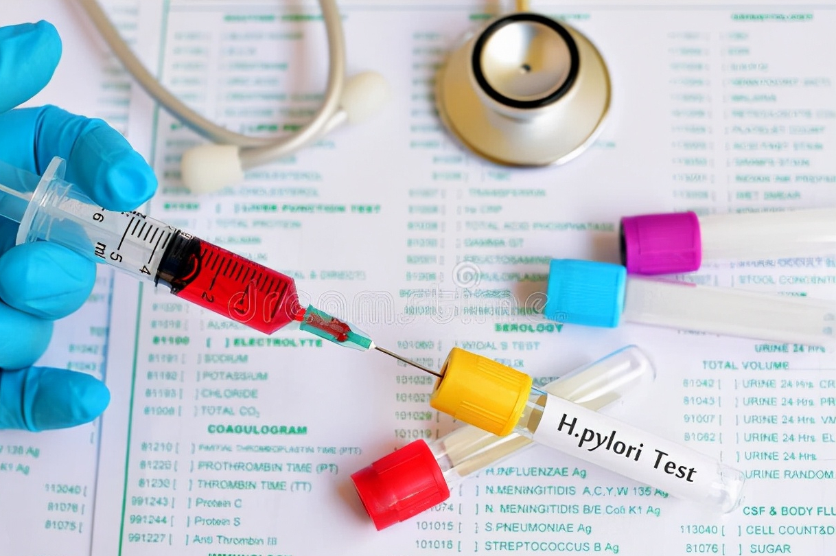 幽门螺杆菌检查值2000,就离胃癌不远了?辟谣为你讲出实情休闲区蓝鸢梦想 - Www.slyday.coM 幽门螺杆菌检查值2000,就离胃癌不远了?辟谣为你讲出实情休闲区蓝鸢梦想 - Www.slyday.coM