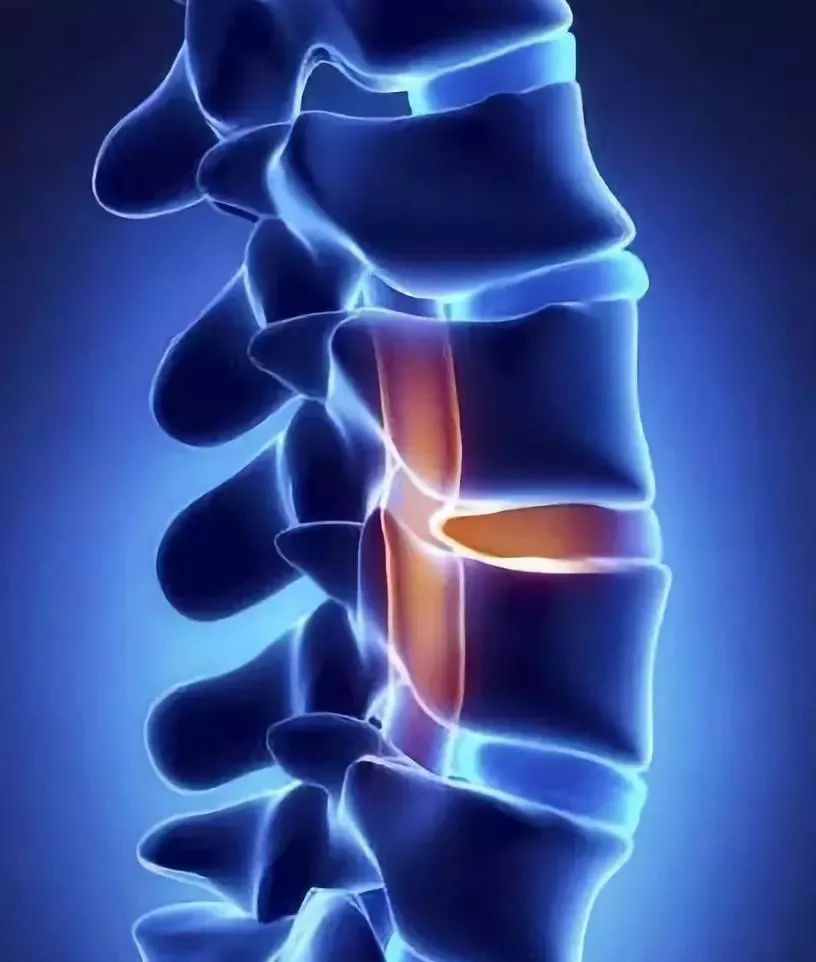 调理脊椎预防108种疾病