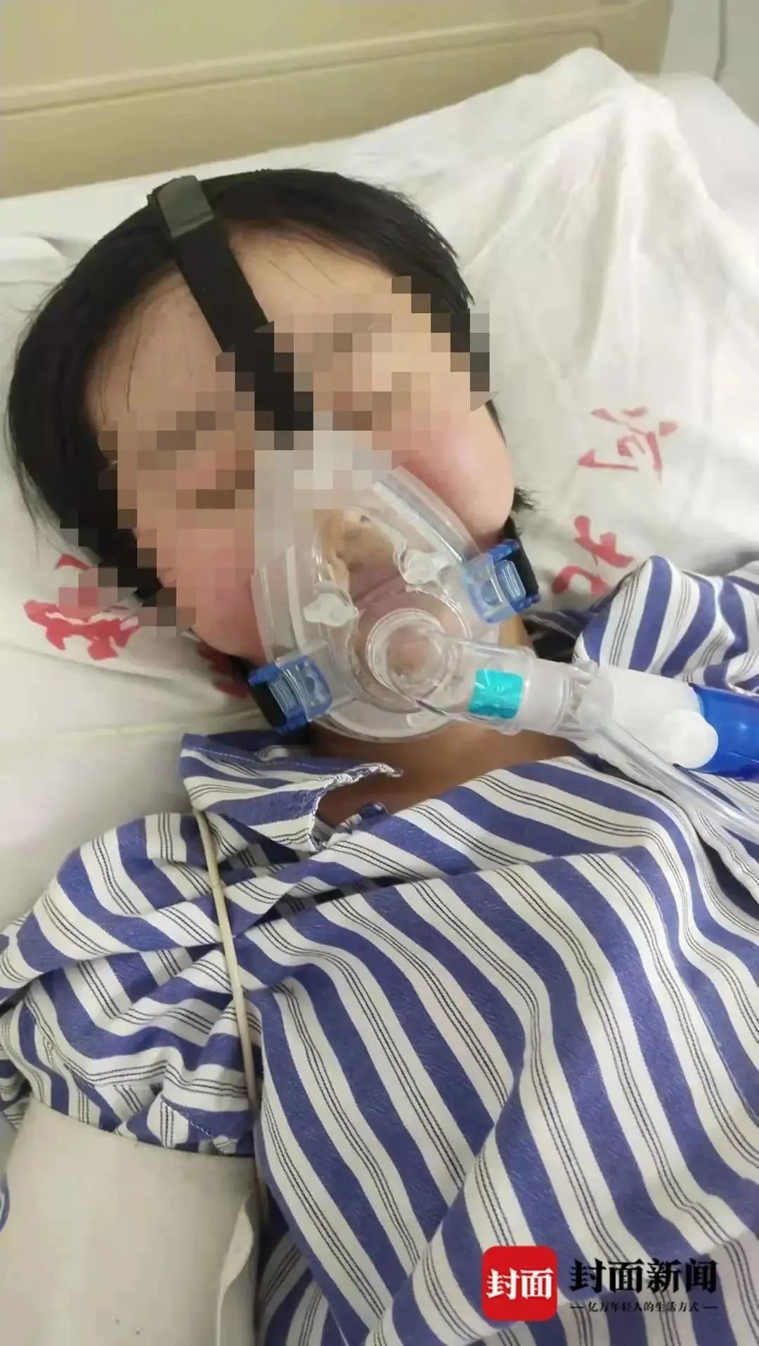 被姐夫投毒百草枯女孩完成肺移植，已苏醒！休闲区蓝鸢梦想 - Www.slyday.coM