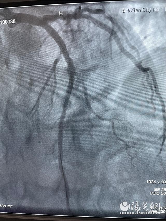 西安市第一医院成功救治一名39岁急性心梗患者休闲区蓝鸢梦想 - Www.slyday.coM