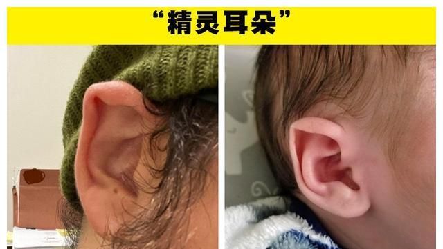 天生拥有精灵耳朵的人只有少数人拥有的7个奇怪身体特征