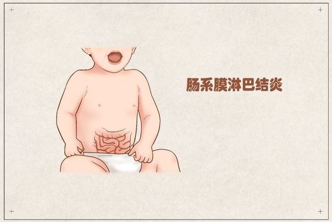 中医儿科杨晓孩子肚子痛反反复复家长需警惕肠系膜淋巴结炎