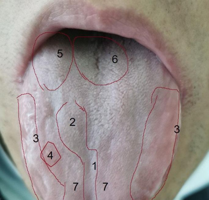 阴阳两虚脾肾不足一剂补天大造丸可阴阳双补脾肾同治