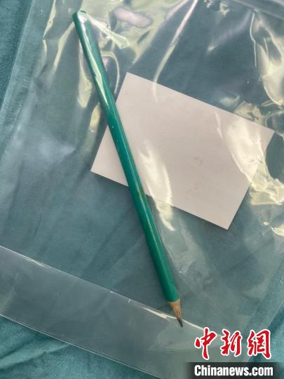 医生取出的铅笔 武汉儿童医院神经外科供图