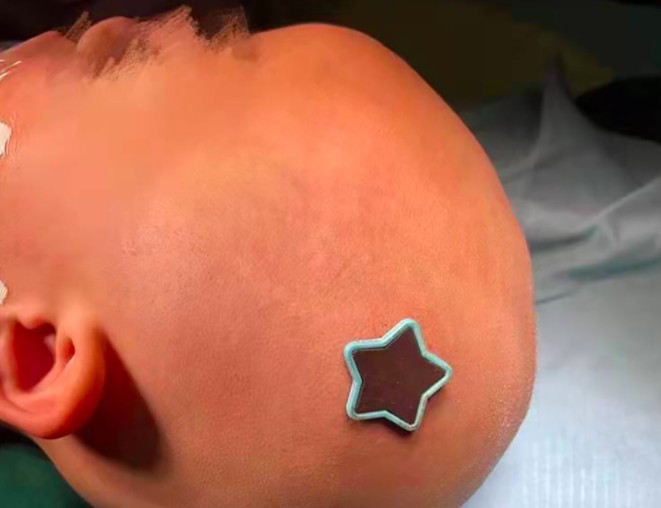 揪心！3岁女童从床上跌落，一颗钉子插入颅内......休闲区蓝鸢梦想 - Www.slyday.coM