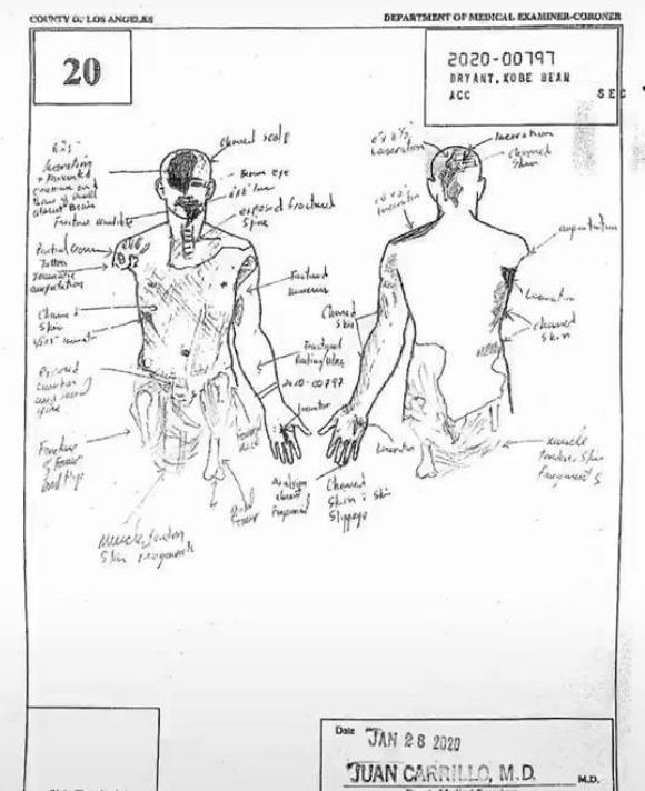 科比照片泄露案继续,法庭驳回撤销请求,瓦妮莎公布遗体修正图休闲区蓝鸢梦想 - Www.slyday.coM 科比照片泄露案继续,法庭驳回撤销请求,瓦妮莎公布遗体修正图休闲区蓝鸢梦想 - Www.slyday.coM