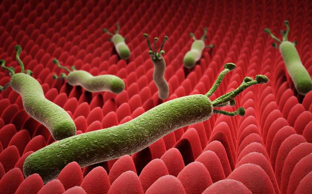 一级致癌物幽门螺杆菌，感染了就会得胃癌？我们该如何预防？休闲区蓝鸢梦想 - Www.slyday.coM