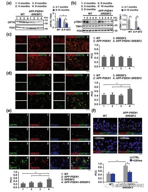 molneurodegener胆固醇如何影响阿尔茨海默病线粒体自噬
