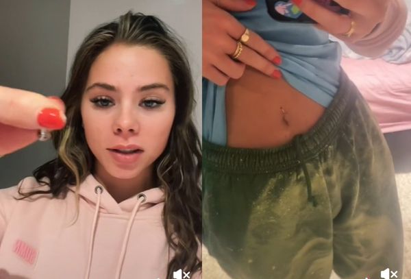 来自埃塞克斯郡的凯利在tiktok拍摄影片表示,她8年前打了肚脐环,近来