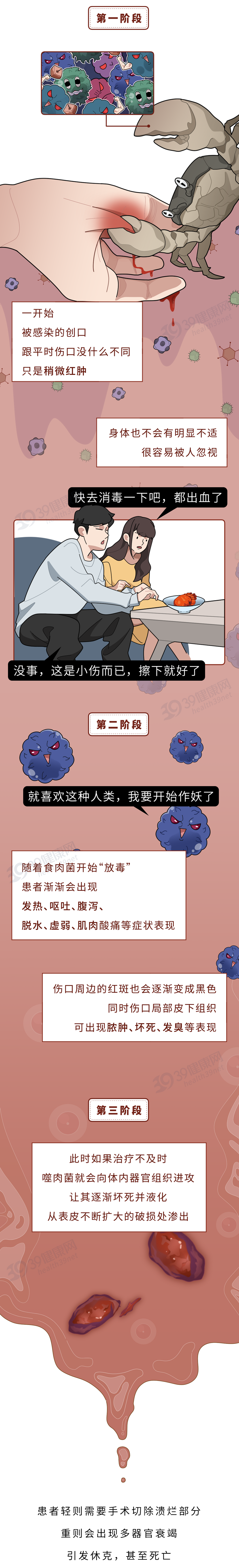 被食肉菌感染有什么症状?