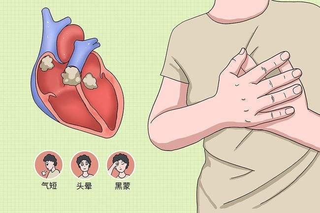 中医儿科杨晓:感冒长期不好警惕引发心肌炎,如何识别预防心肌炎