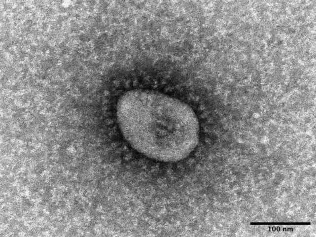 新冠病毒显微镜下图片图片