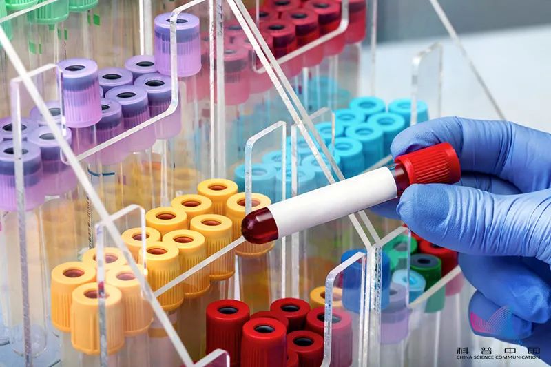 采血用什么管为啥抽血的管子是五颜六色的？奇奇怪怪的知识又增加了_https://www.jmylbn.com_新闻资讯_第1张