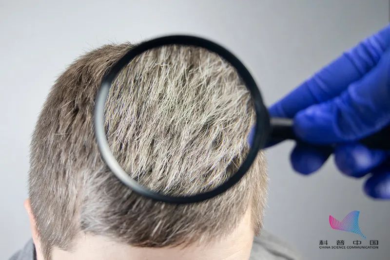 为什么压力大时会长白头发？这些习惯可能会催生白发…休闲区蓝鸢梦想 - Www.slyday.coM