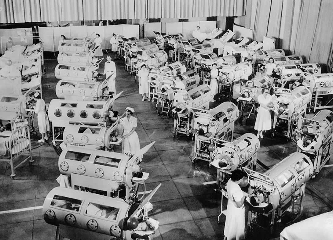 被困铁桶70年的铁肺人一生无法呼吸断电意味着死亡