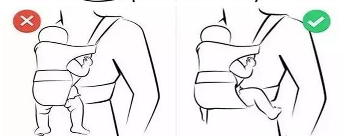 婆婆给新生儿绑腿被医生批，想要娃有双美腿，家长还应避免5件事休闲区蓝鸢梦想 - Www.slyday.coM