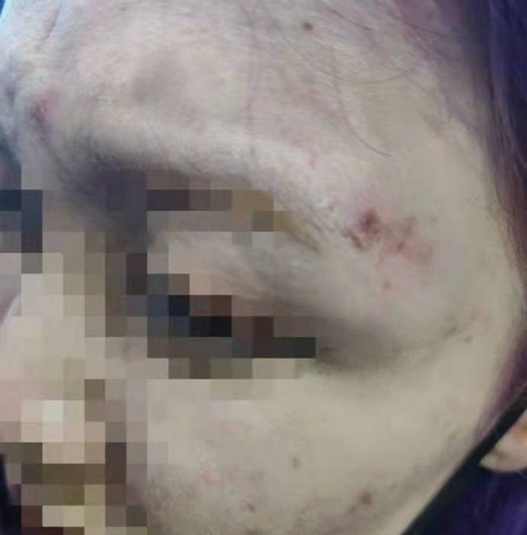 丑闻!山东泰山球员酒吧殴打女生,受害者遍体鳞伤,警方介入调查休闲区蓝鸢梦想 - Www.slyday.coM 丑闻!山东泰山球员酒吧殴打女生,受害者遍体鳞伤,警方介入调查休闲区蓝鸢梦想 - Www.slyday.coM