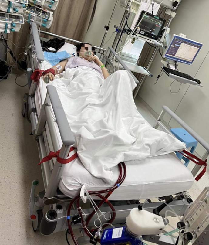 全国首例国产ecmo在阜外医院成功救治一名患者