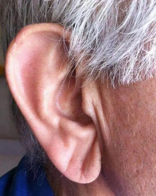 脸上有3种"皱纹",是健康的预警,要提高警惕|皱纹|耳垂|上眼皮_新浪