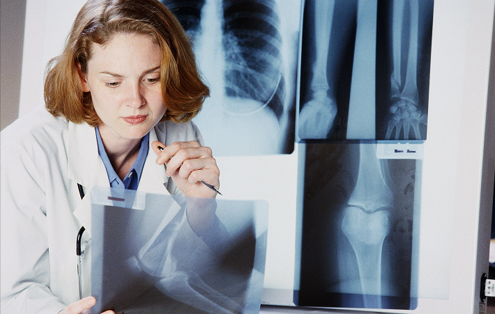 女性更应该关注骨骼健康如何降低骨质疏松的风险运动很重要