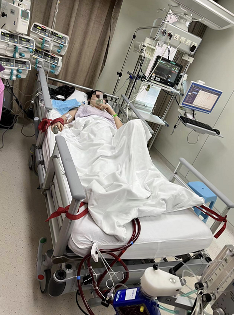 全国首例国产ecmo在阜外医院成功救治一名患者