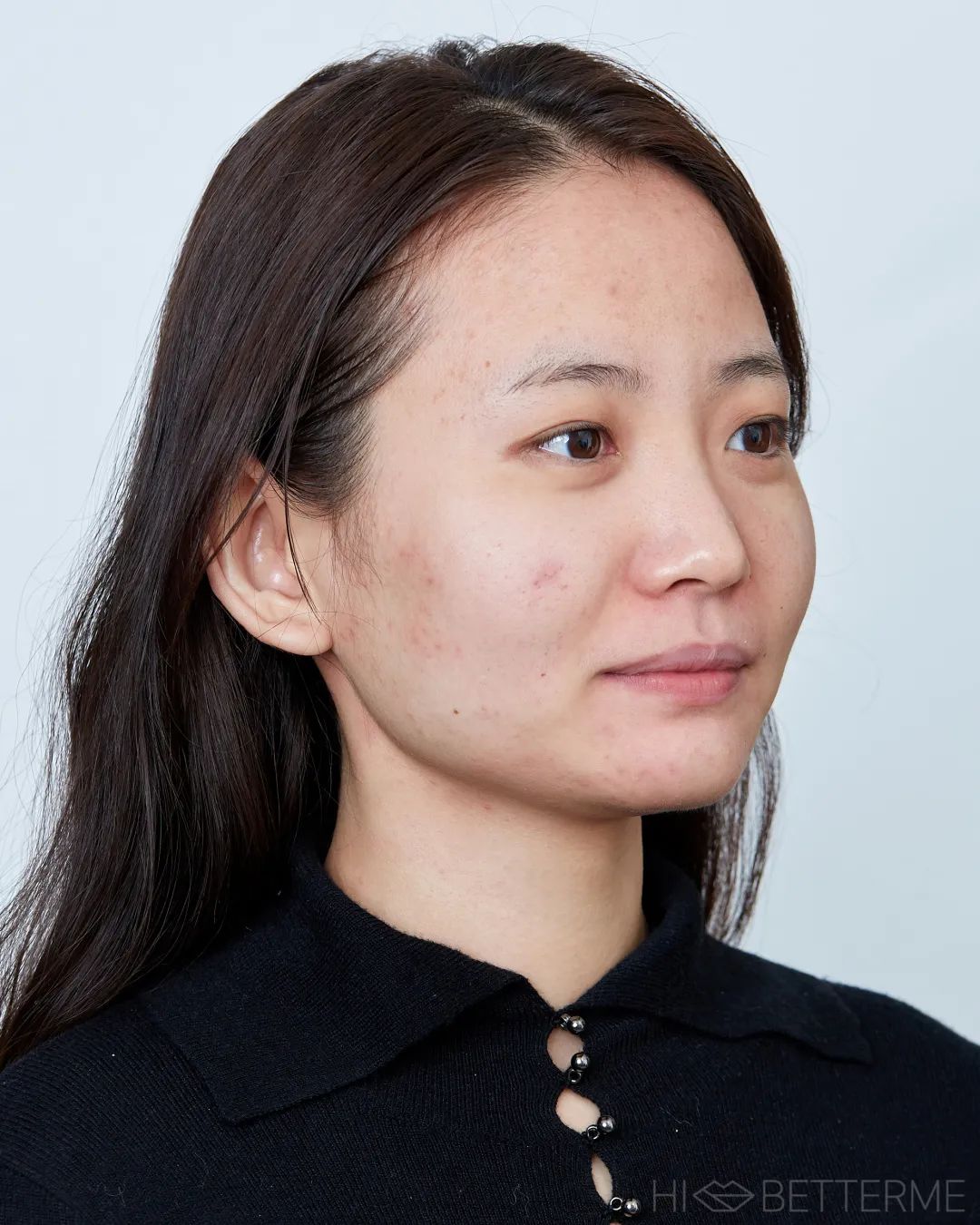 素人改造 | 方脸瑕疵皮女孩,变身港风明艳美人!