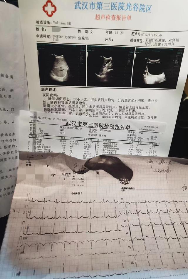 流动性出血,从陈女士提供的超声检查报告单来看,所幸孩子的肝胆胰脾肾