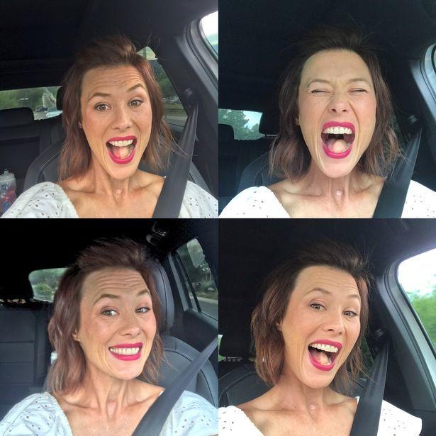 美国女子因病切除半侧舌头,医生妙手回春,用大腿肌肉将其补齐|卡梅隆