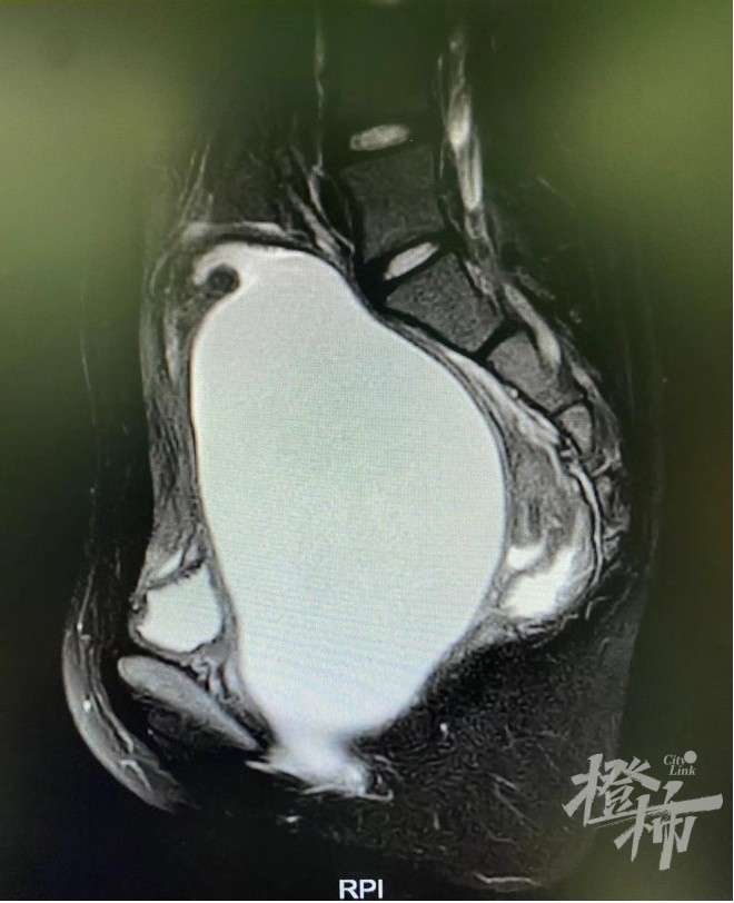 女生初二了还没来月经，腹痛难忍错过期末考试，竟是因为“大姨妈”被堵住了休闲区蓝鸢梦想 - Www.slyday.coM