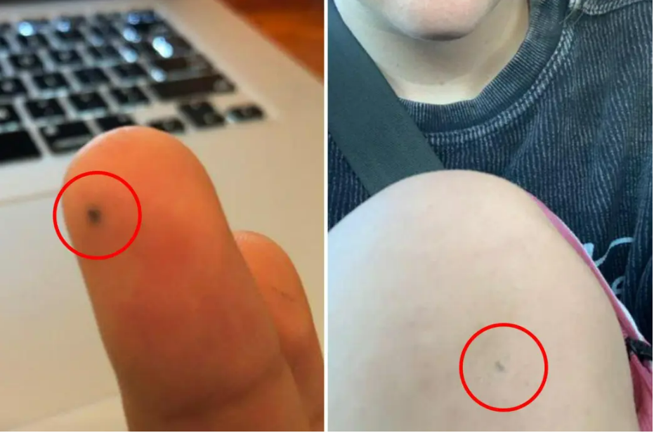 扎进手里的铅笔芯会不会对身体有伤害啊