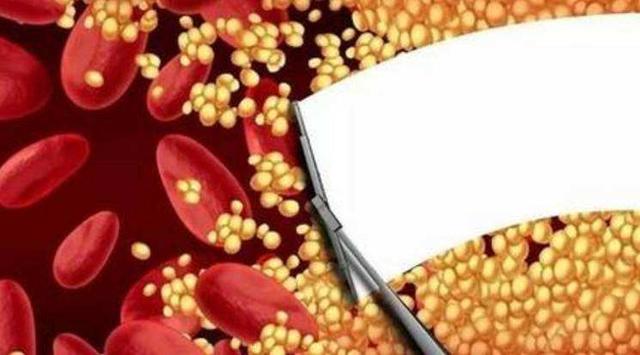 连续吃一个月的洋葱，可以降血脂？今天的答案有点不一样休闲区蓝鸢梦想 - Www.slyday.coM