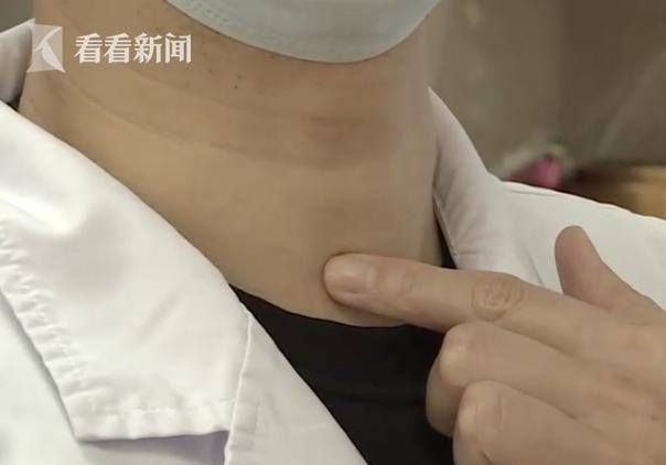 女子颈部长"包"反复疼痛"元凶"竟是10个月前的一根鱼刺|田鑫_新浪新闻