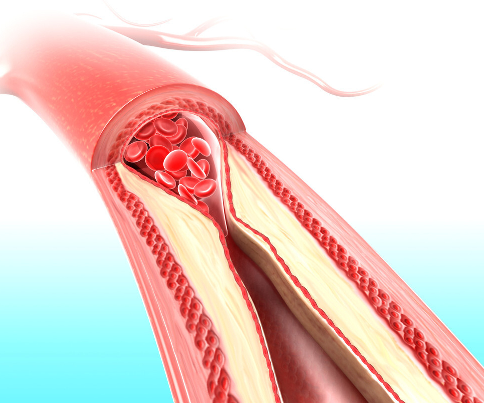 疏通血管丹参和三七哪个更好能否长期食用本文讲出实情