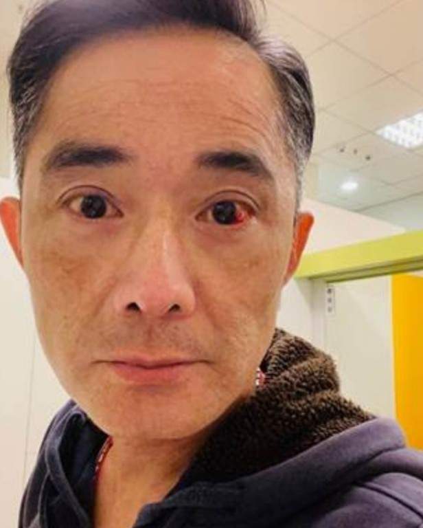 在江国宾晒出的照片中可以看出,他的满眼通红都是血丝,连眼眶都已经有