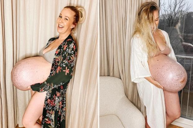 丹麦三胞胎妈妈分享壮观孕肚照片，超1400万人观看，母亲真伟大