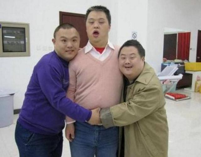 为什么患唐氏综合征的人,没有遗传父母的外貌,长相都极其相似?__财经