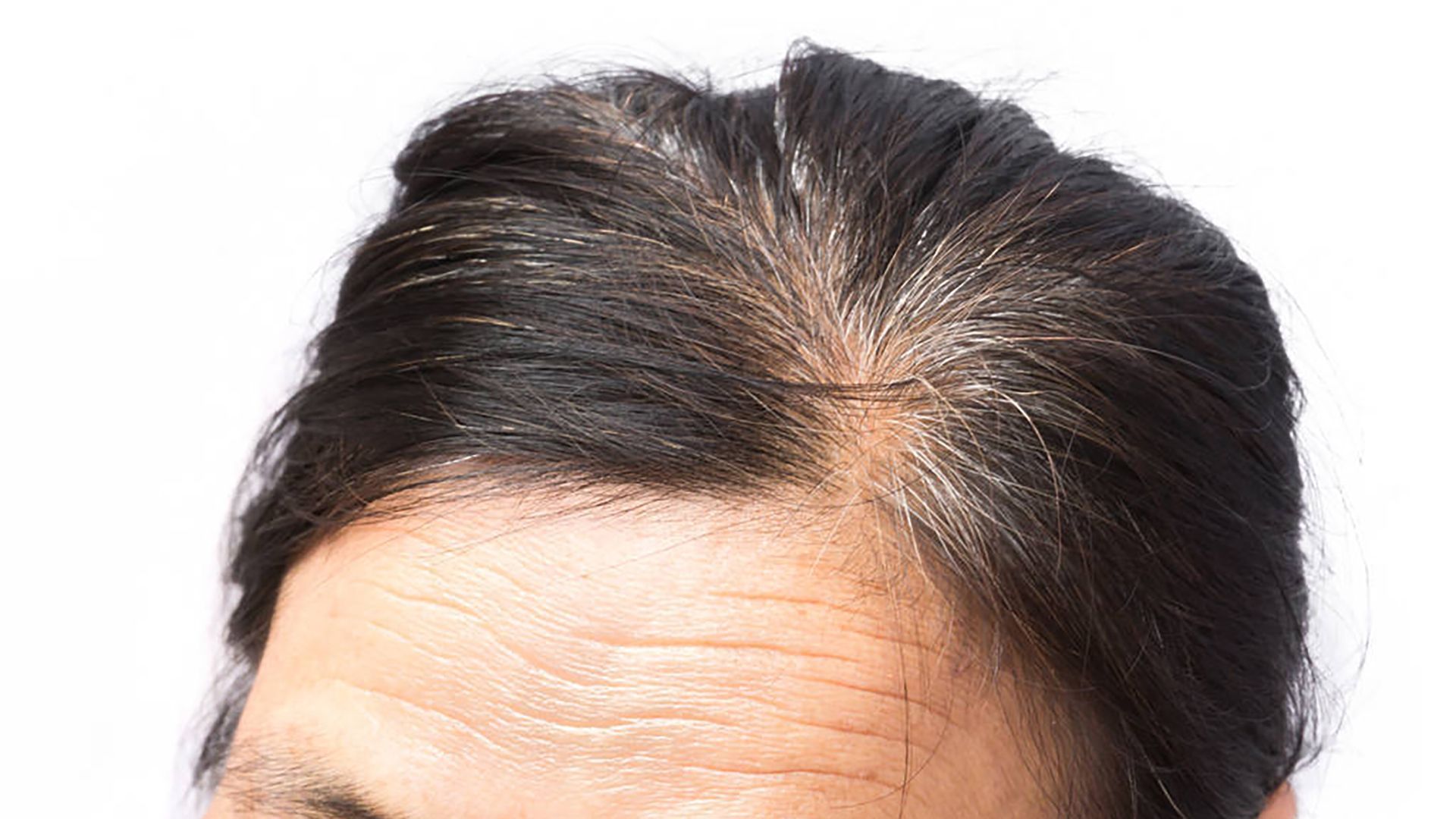 女生白头发增多不要总觉得老了或是由于体内缺乏这3种营养女生白头发