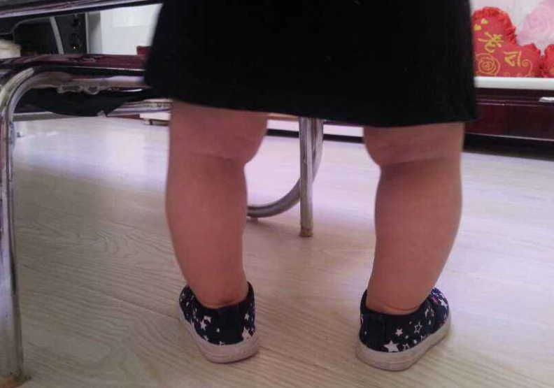 3大误区影响宝宝腿部发育不尽早改正小心娃的腿又弯又短