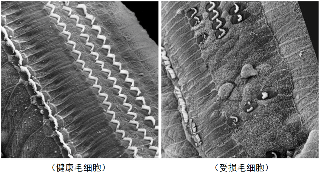 经常戴耳机会影响听力吗？多大分贝会损伤？终于找到解决办法了！休闲区蓝鸢梦想 - Www.slyday.coM
